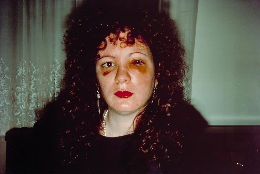 Nan one month after being battered, Nan Goldin 